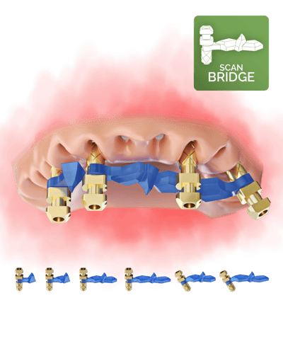 2025_FullArch newsletter_ScanBridge 2025_FullArch newsletter_ScanBridge