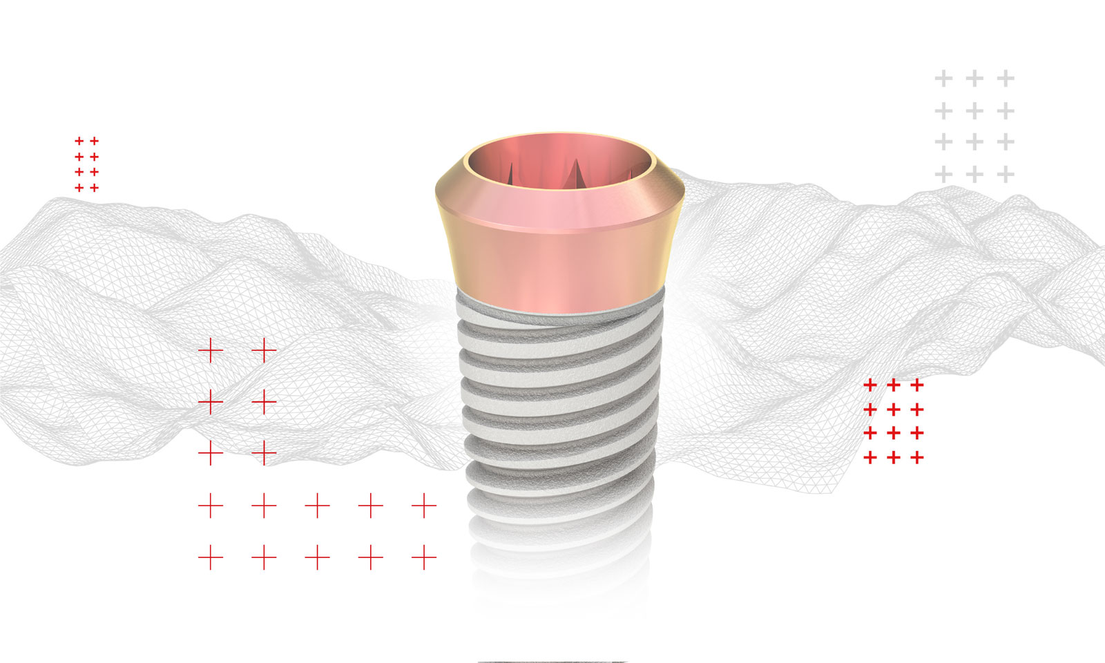 Header-caso-Ionescu_02-01